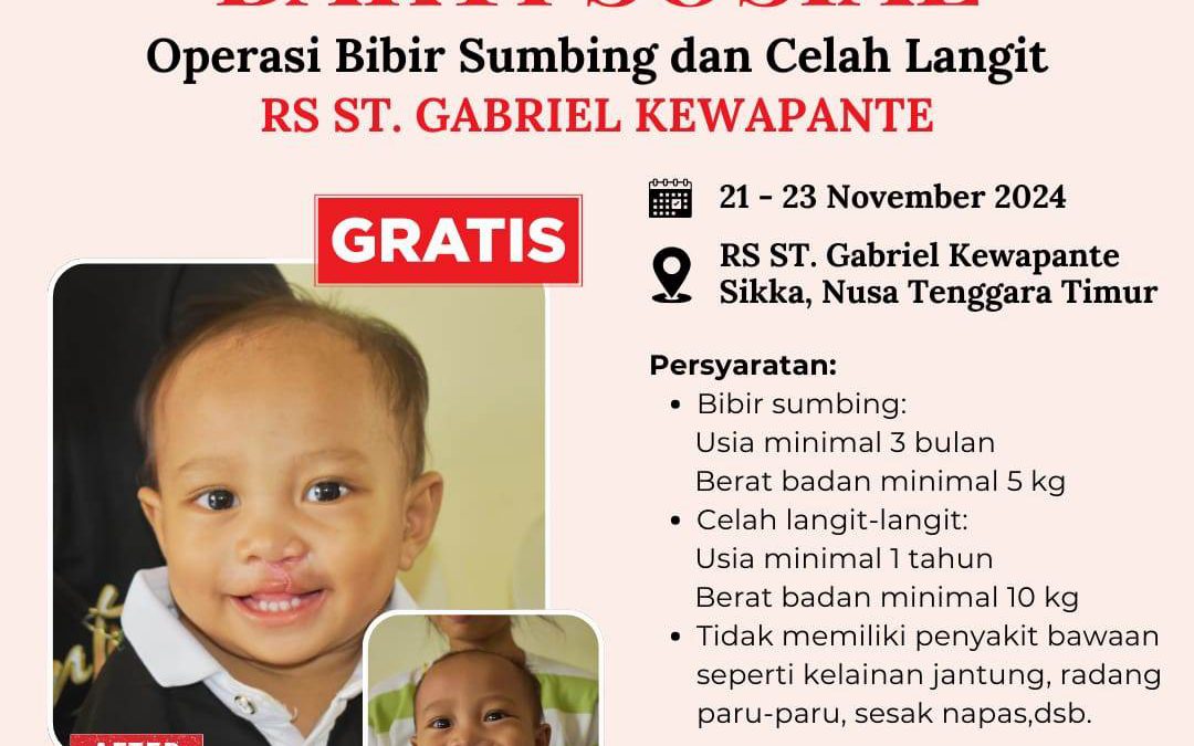 BAKTI SOSIAL (Operas Bibir Sumbing dan Celah Langit